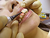ぺリオマイクロ40（顕微鏡で見る歯周病検査）